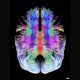Illustration for article titled Watching Your Brain Freak Out on a Scanner Calms You Down